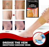 VaricoRelief™ 12PCS Herbal Patches for Varicose & Spider Veins