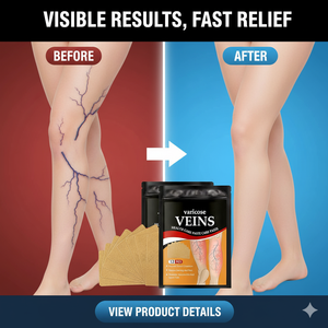 VaricoRelief™ 12PCS Herbal Patches for Varicose & Spider Veins